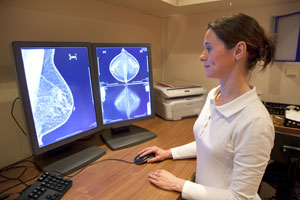 Mamografía unilateral en Hospital Infanta Luisa