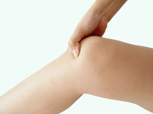 Prótesis total de rodilla en Clínica La Luz Prótesis total de rodilla en Clínica La Luz