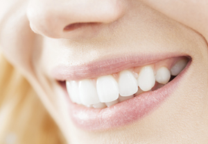 Blanqueamiento dental combinado en Clínica Dental Remodent