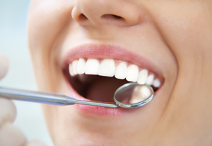 Extracción de cordal incluido en Clínica Dental Remodent