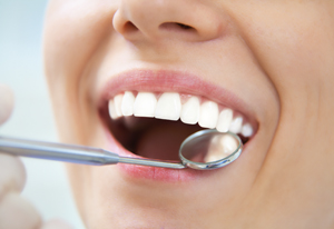 Consulta odontológica con limpieza bucal en Clínica Dental Cea Bermúdez 46