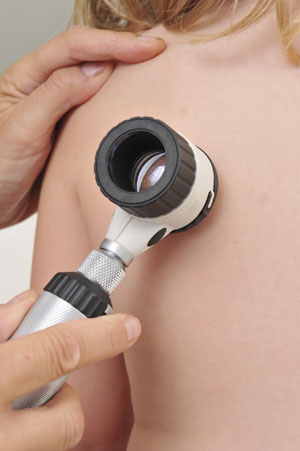 Crioterapia en Centro Médico Somosaguas Crioterapia en Centro Médico Somosaguas