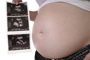 Ecografía fetal de segundo trimestre   en Hospital Casa de Salud
