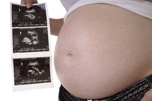Ecografía fetal de segundo trimestre en Hospital Casa de Salud Ecografía fetal de segundo trimestre en Hospital Casa de Salud