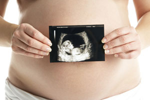 Ecografía fetal de tercer trimestre   en Hospital Casa de Salud