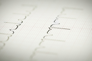 Electroencefalograma en Unidad Médica Angloamericana Electroencefalograma en Unidad Médica Angloamericana