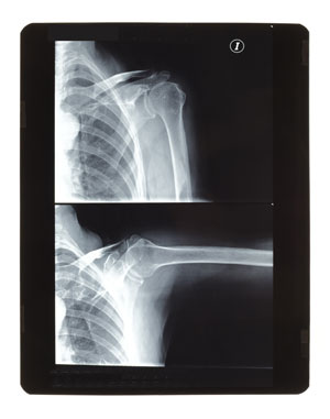 Radiografía: dos proyecciones en Hospital Casa de Salud