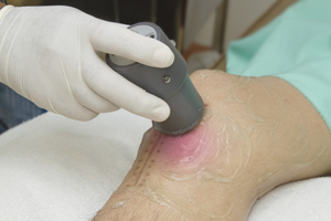 Ecografía musculoesquelética o articular en Centro Médico Somosaguas Ecografía musculoesquelética o articular en Centro Médico Somosaguas