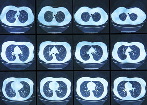Radiografía: dos proyecciones en Clínica Wellcare Médica