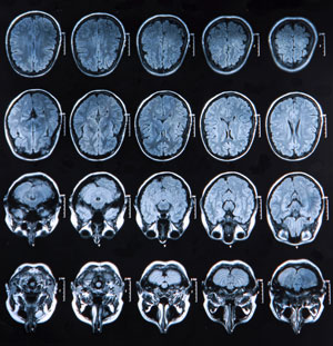 TAC en una zona con contraste en Centro Radiología IMD Sabadell