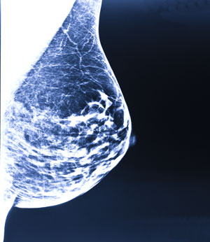 Mamografía unilateral en Hospital Viamed Santiago