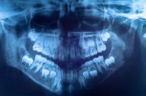 TAC dental (Dentiscan) 1 arcada en Hospital Medimar