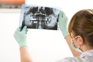 Ortopantomografía en Clínica Dental Cea Bermúdez 46