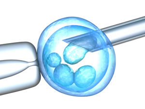 Ciclo de FIV con donación de ovocitos en Instituto de Fertilidad Palma