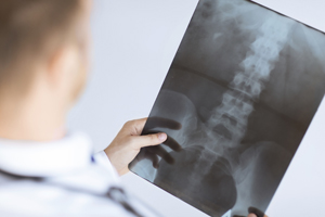 Radiografía: dos proyecciones en Clínica Nexo Radiografía: dos proyecciones en Clínica Nexo