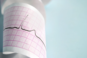 Primera visita con EKG en Centro Medico Concheiro