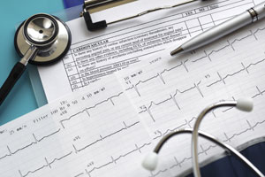 Electrocardiograma sin informar en Centro Médico Somosaguas