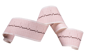 Holter de EKG 24 horas en Instituto Cardiología y Medicina interna