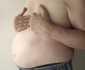 Cirugía de la obesidad (cirugía bariátrica) con manga gástrica en Centro Médico Teknon Barcelona Cirugía de la obesidad (cirugía bariátrica) con manga gástrica en Centro Médico Teknon Barcelona